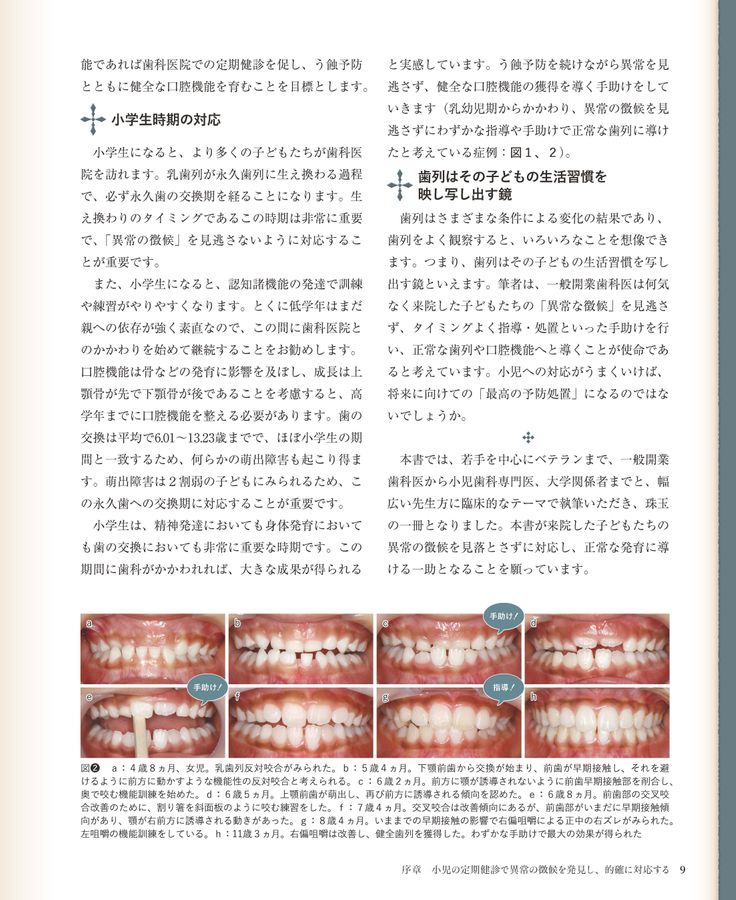 臨床の玉手匣 小児歯科篇