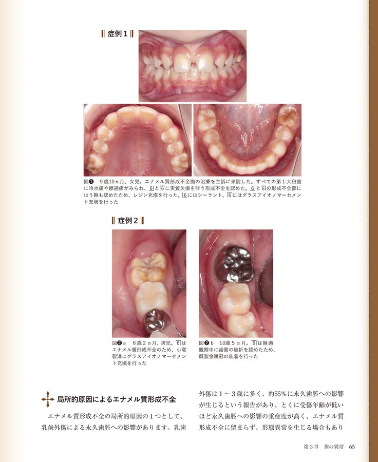 お得なセット商品 臨床の玉手匣 小児歯科篇 nacm.jp