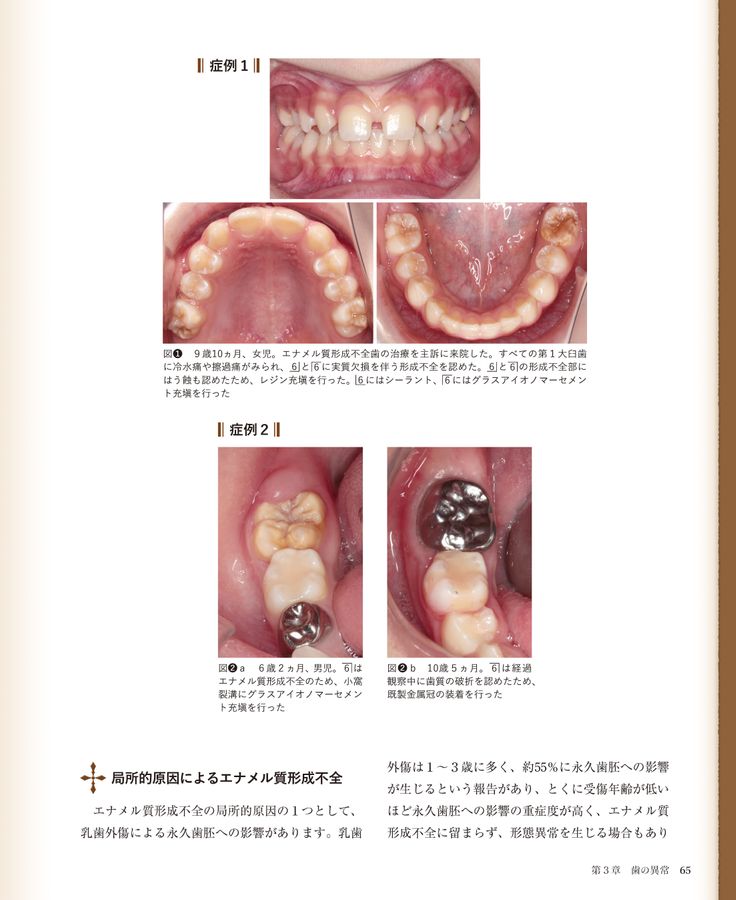 【裁断済】臨床の玉手匣小児歯科篇 臨床の玉手匣 小児歯科篇| 歯科総合出版社 デンタルダイヤモンド社