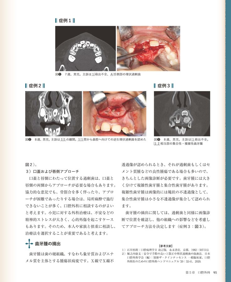 【裁断済】臨床の玉手匣小児歯科篇 臨床の玉手匣 小児歯科篇