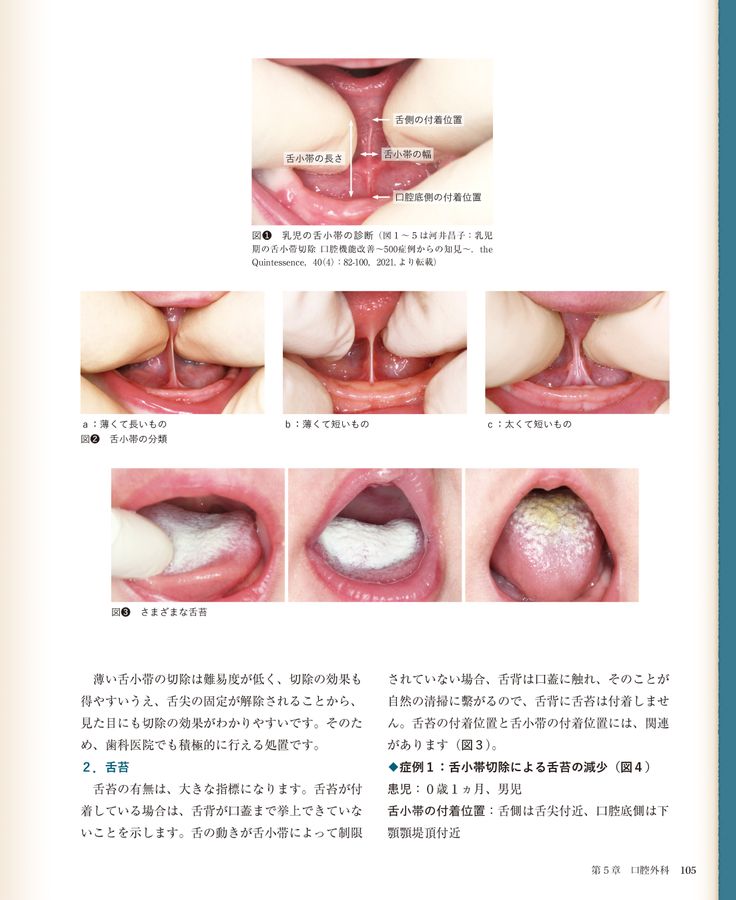 【裁断済】臨床の玉手匣小児歯科篇 臨床の玉手匣 小児歯科篇 臨床の玉手匣 小児歯科篇 | 試し