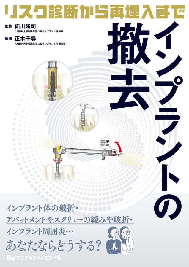 【裁断済】インプラントの撤去リスク診断から再埋入まで インプラントの撤去 ～リスク診断から再埋入まで～| 歯科総合