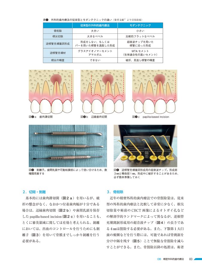 精密歯科治療 ここまできたか！マイクロスコープいろいろ活用術
