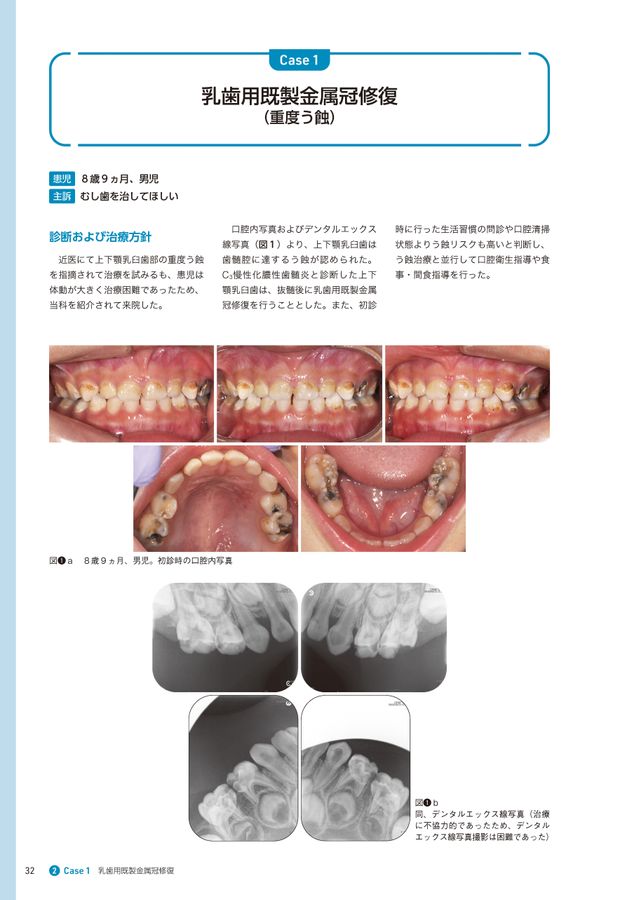歯科衛生士とともに学ぶ GPのための小児歯科ケーススタディ