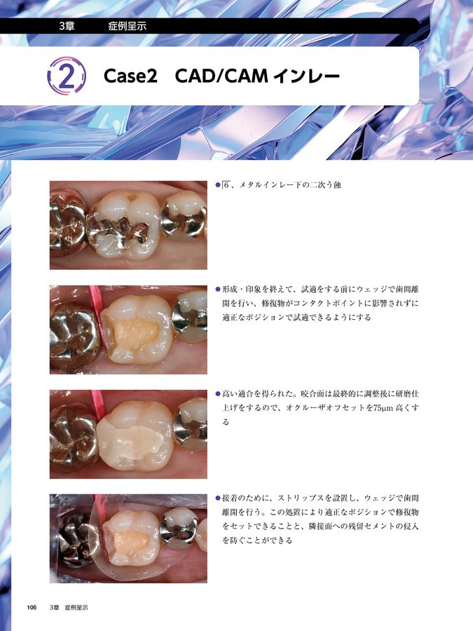 保険改定対応 CAD/CAM修復物入門 CAD/CAM冠、CAD/CAMインレー