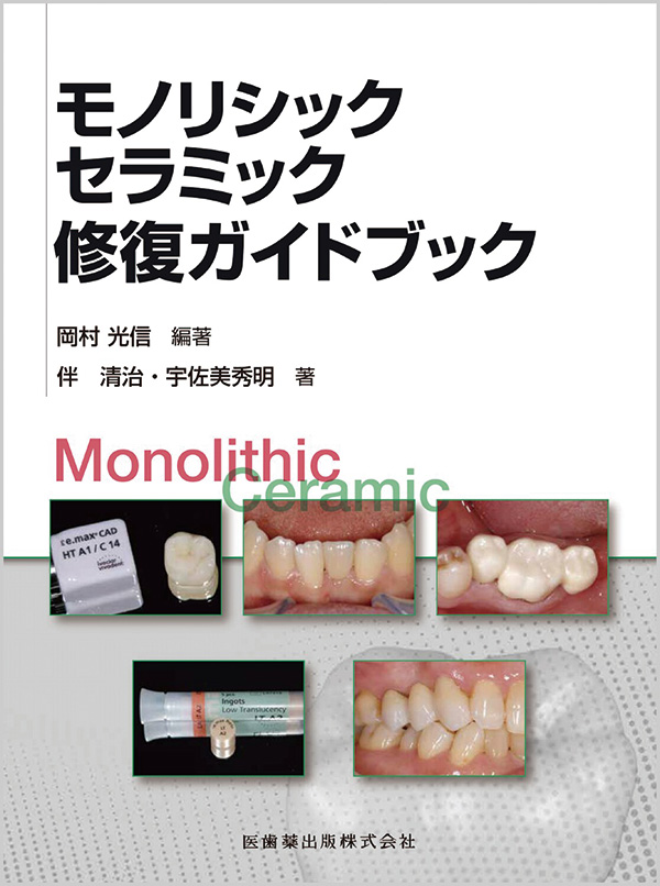 モノリシックセラミック修復ガイドブック | 【歯科学】新刊書籍