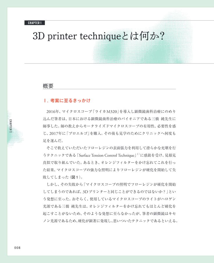 フリーハンドの II級窩洞CR充填 3D printer technique 脱マトリックス！フリーハンドのII級窩洞CR充填 3D printer
