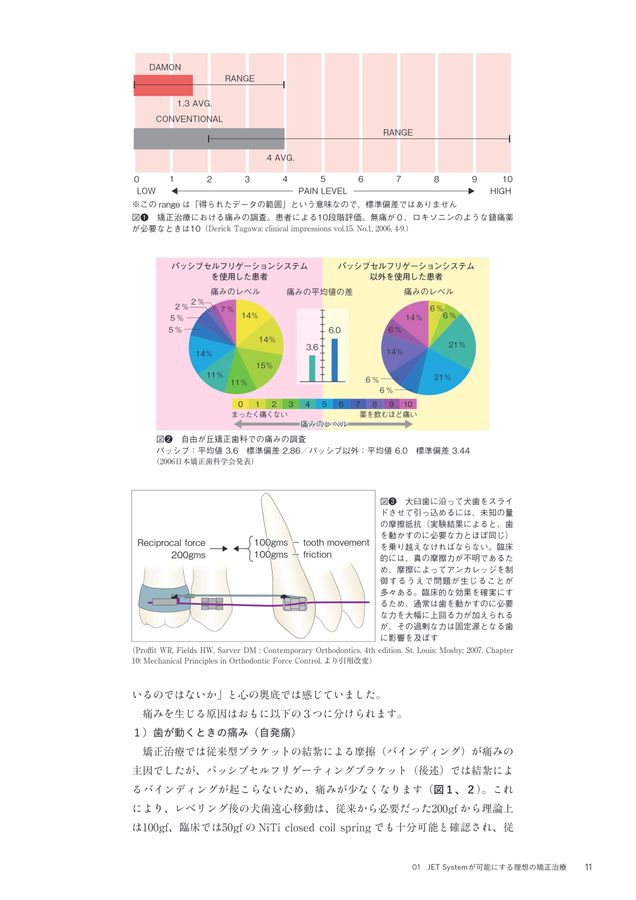 超入門 JET System矯正 Ⅰ級叢生4444抜歯編