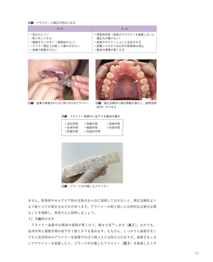 歯科医師＆歯科衛生士のためのマウスピース矯正入門 New Edition