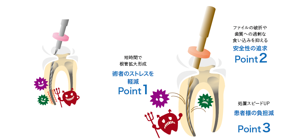 Nitiファイル