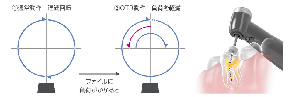 モリタ　トライオートzx2＋