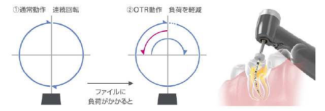 モリタ　トライオートzx2＋