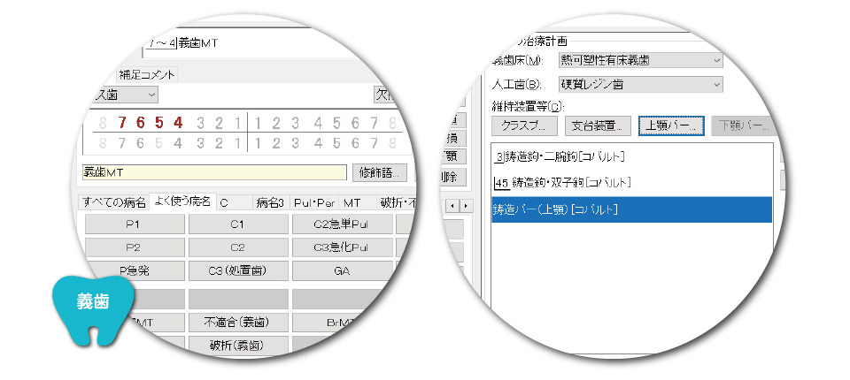 治療計画による診療入力