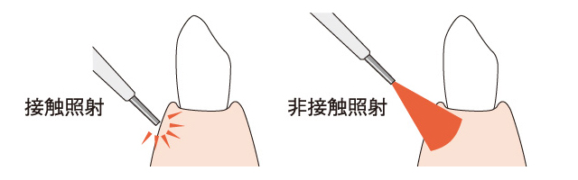 途に合わせた照射方法